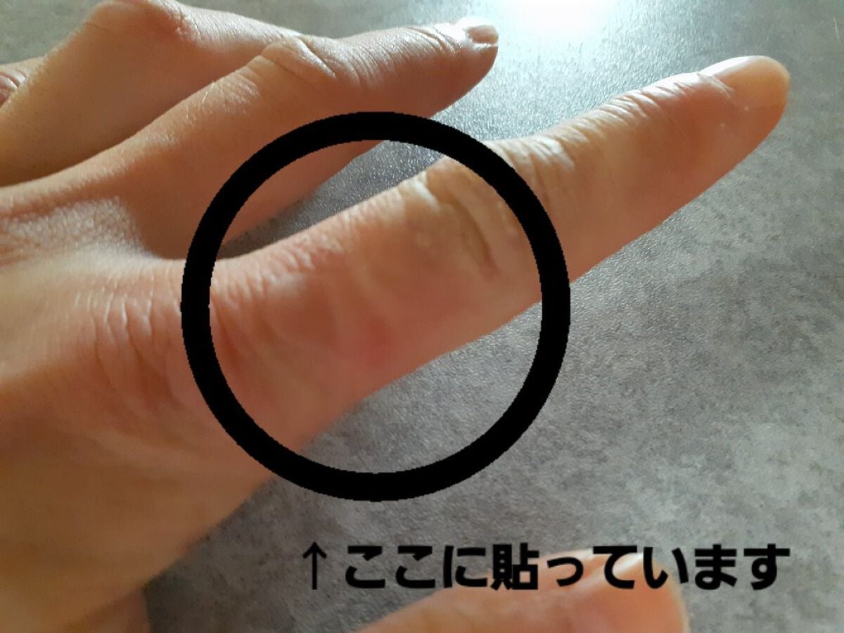 キズクイック/東洋化学/その他を使ったクチコミ(6枚目)