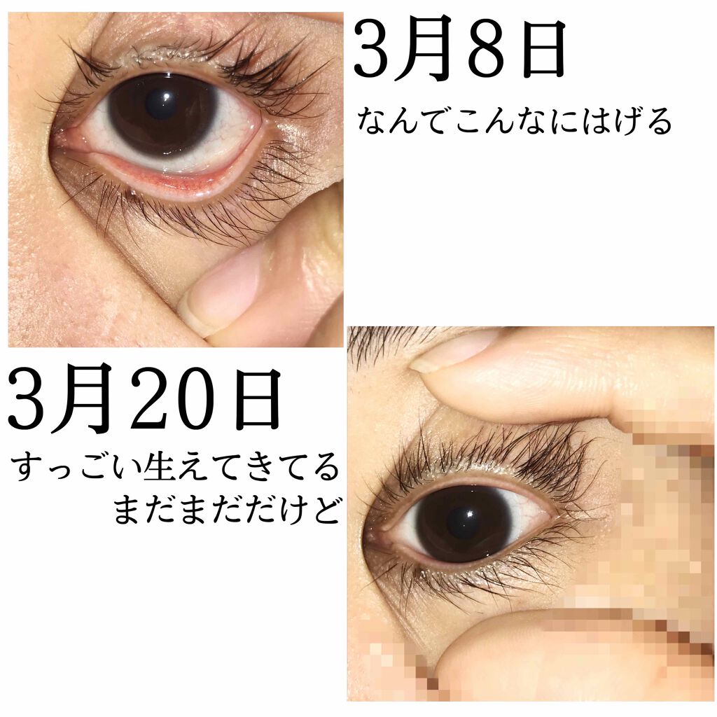 ラッシュジェリードロップ　ＥＸ/MAJOLICA MAJORCA/まつげ美容液を使ったクチコミ（3枚目）