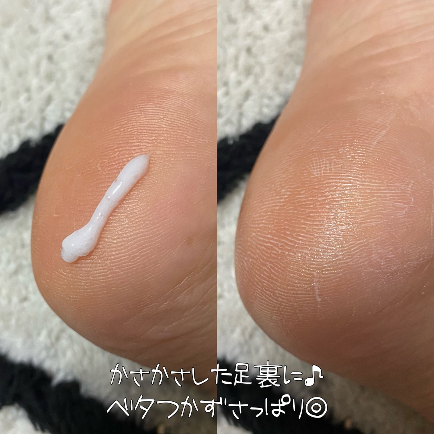 インテンシブフットリペア/Kerasal/レッグ・フットケアを使ったクチコミ(4枚目)