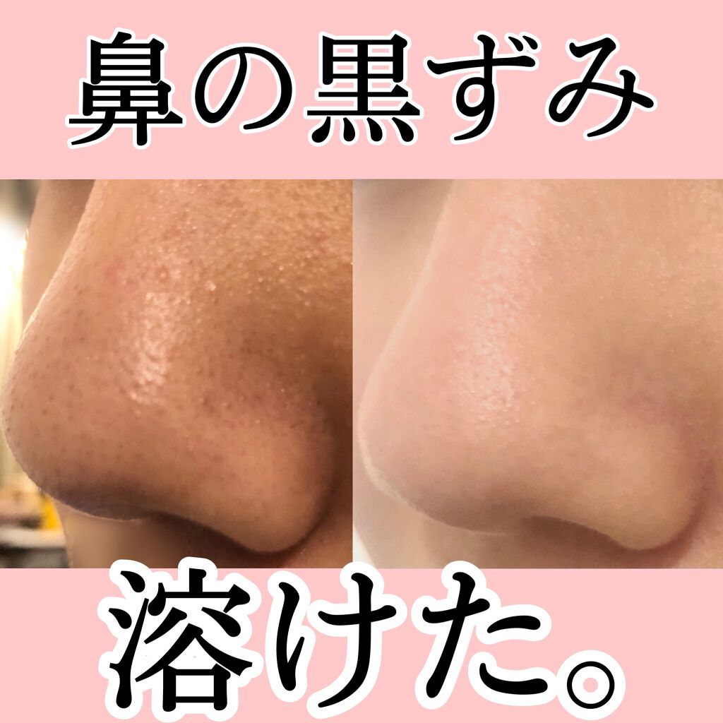 シルコット うるうるコットン/シルコット/コットンを使ったクチコミ(1枚目)