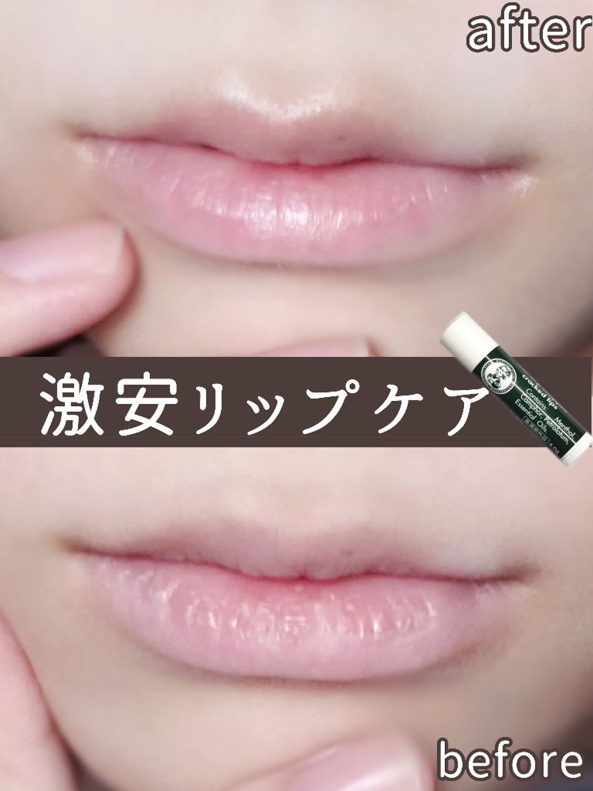 薬用リップスティックXD/メンソレータム/リップクリームを使ったクチコミ(1枚目)