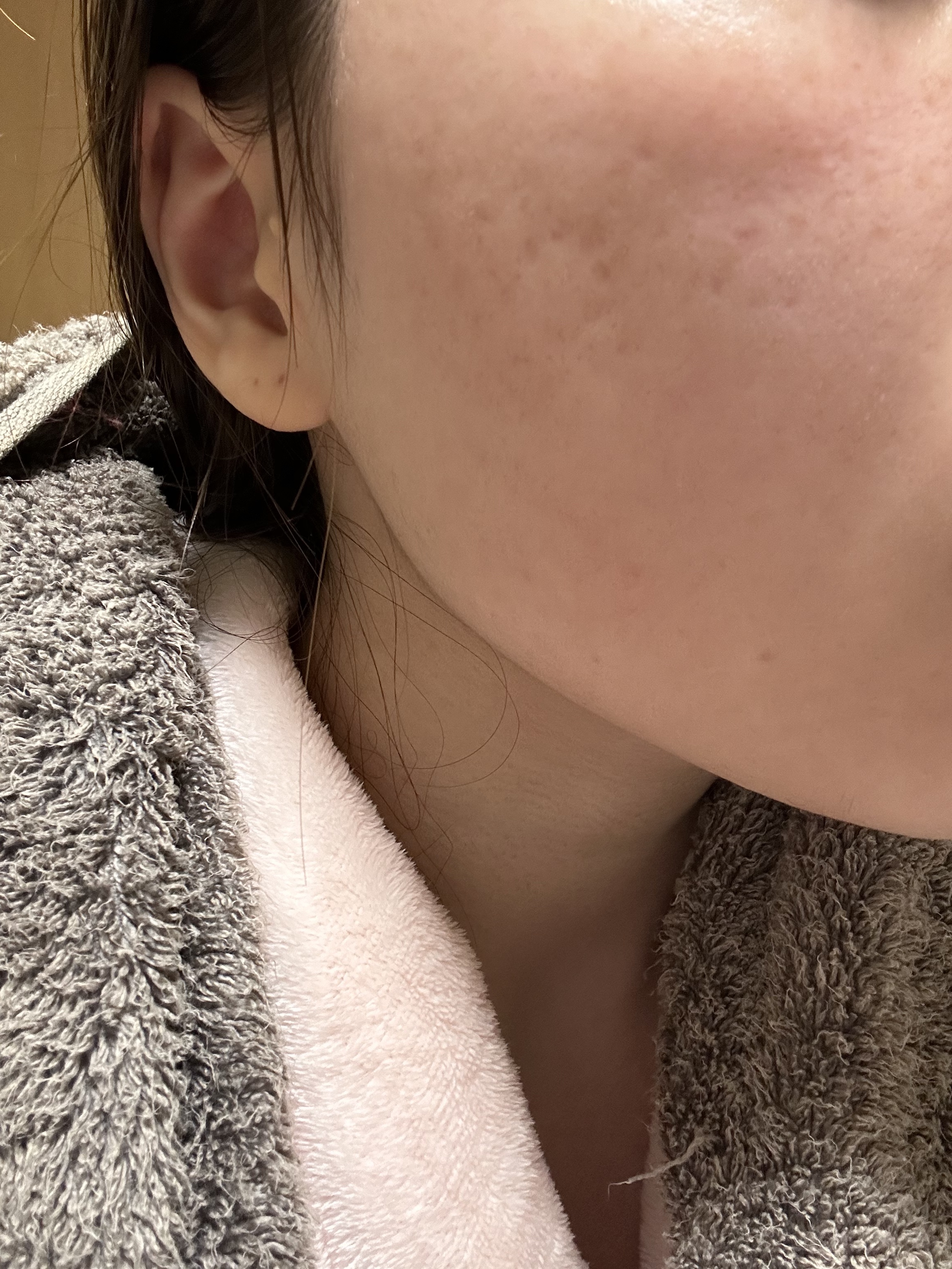 LA10+HAフェイスセラム/The Ordinary/ピーリングを使ったクチコミ（2枚目）