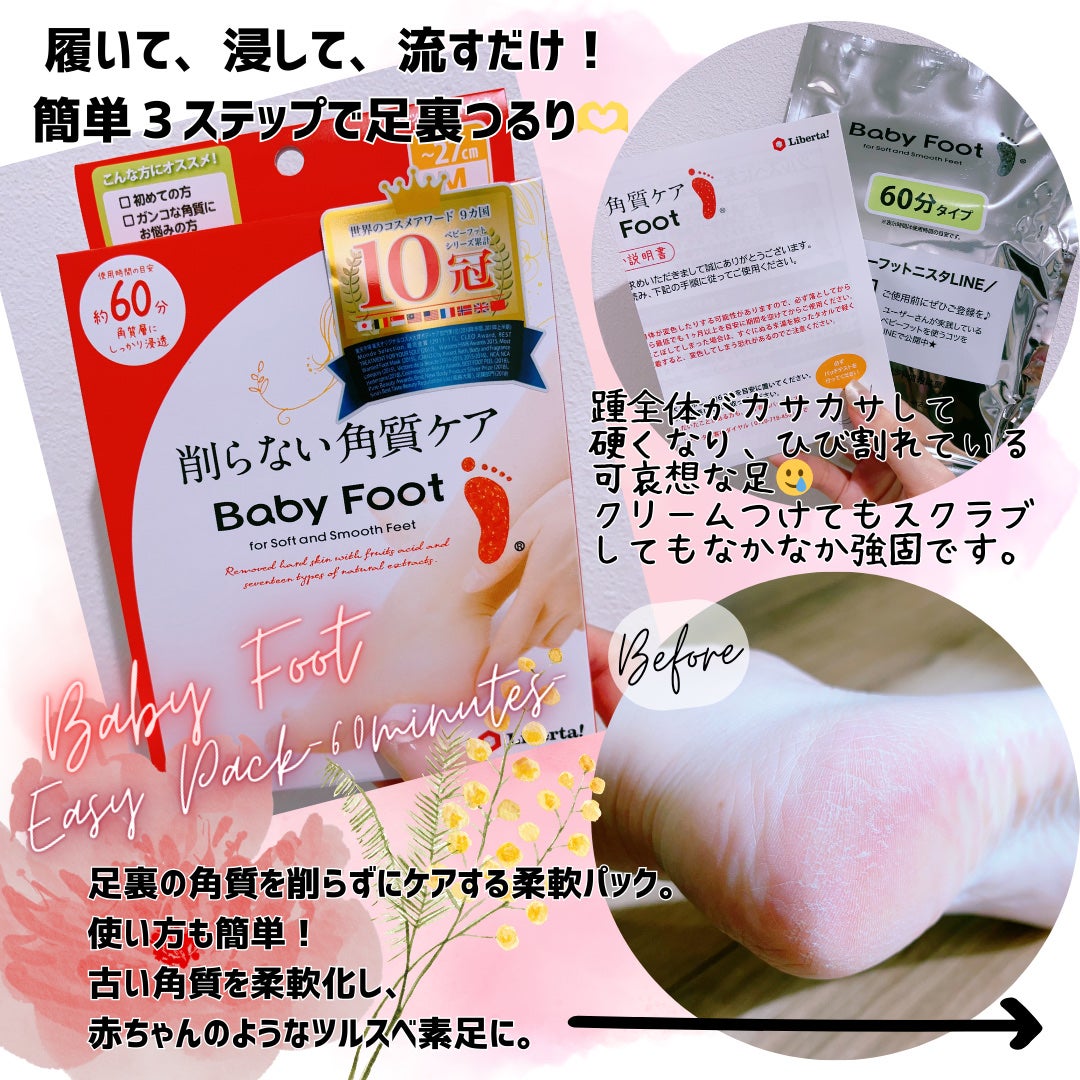 イージーパックDP60分タイプ/ベビーフット/レッグ・フットケアを使ったクチコミ(1枚目)