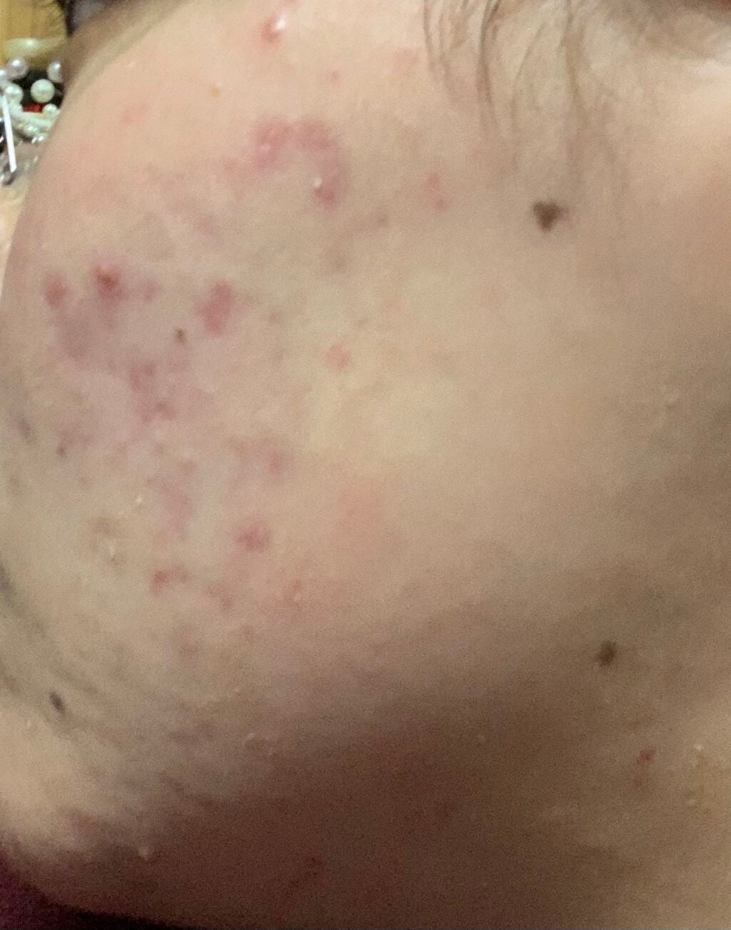 お米のマスク/毛穴撫子/シートマスク・パックを使ったクチコミ(2枚目)