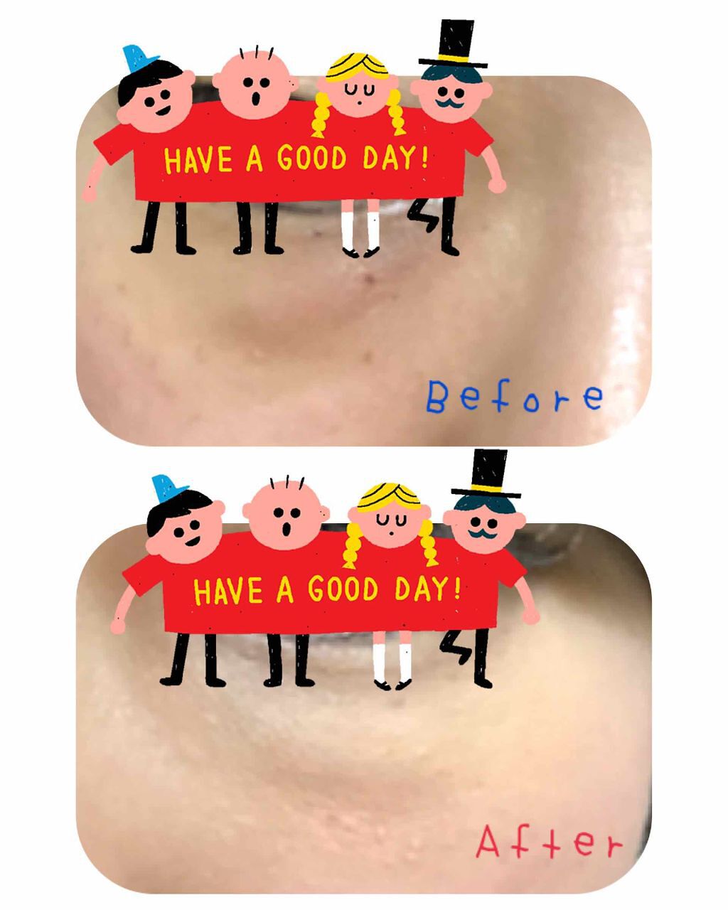 アンダーアイブライトナー/ケサランパサラン/パレットコンシーラーを使ったクチコミ(2枚目)