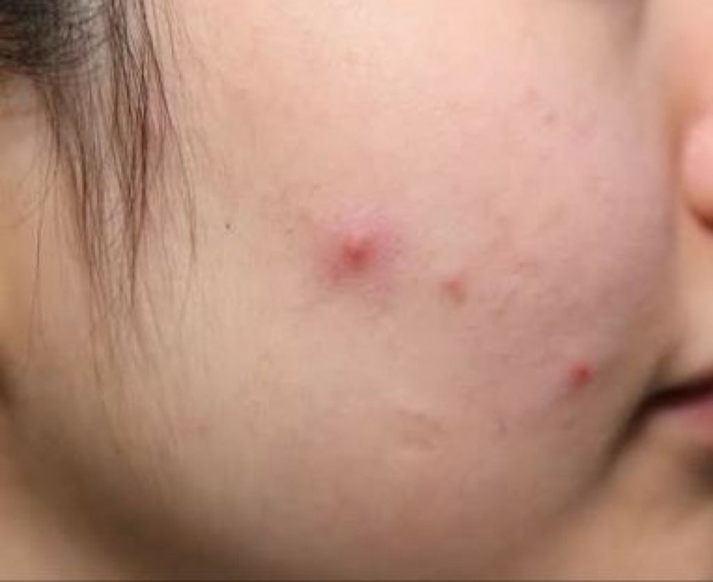 ロゼット洗顔パスタ アクネクリア/ロゼット/洗顔フォームを使ったクチコミ（2枚目）