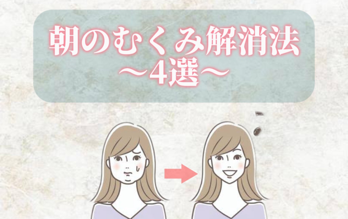 むくみぱっくん 90粒/スベルティ/健康サプリメントを使ったクチコミ（1枚目）