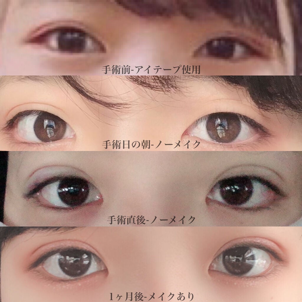 ð¥ã¯ããïŒð¯ on LIPS ããµããæŽåœ¢1ã¶æçµéïŒããã«ã¡ã¯ïŒã¯ããã§ãð¯ä»åã¯ã12/..ãïŒ2æç®ïŒ