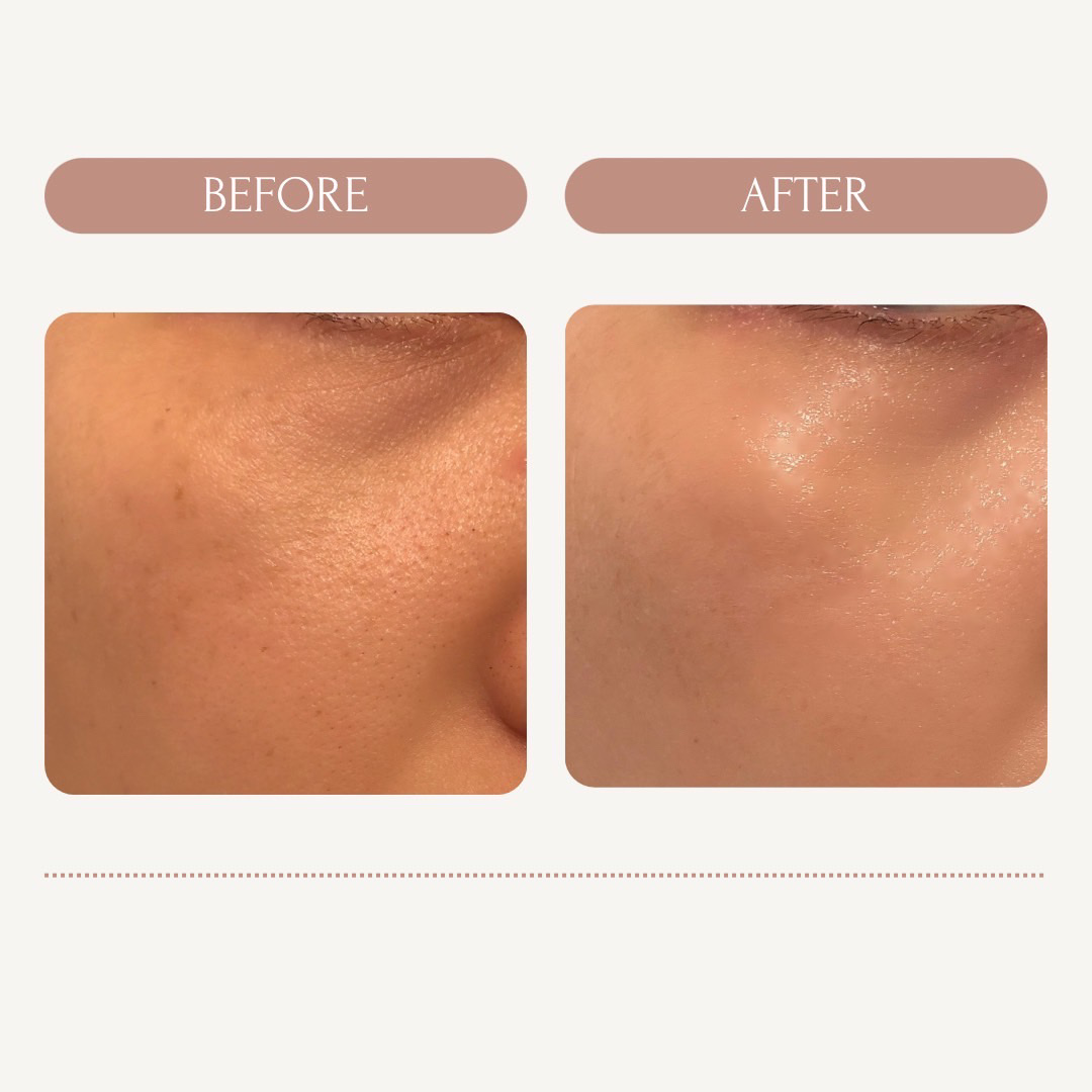 パワーブライトニング グルタチオンクリーム/Dr.Althea/フェイスクリームを使ったクチコミ（2枚目）