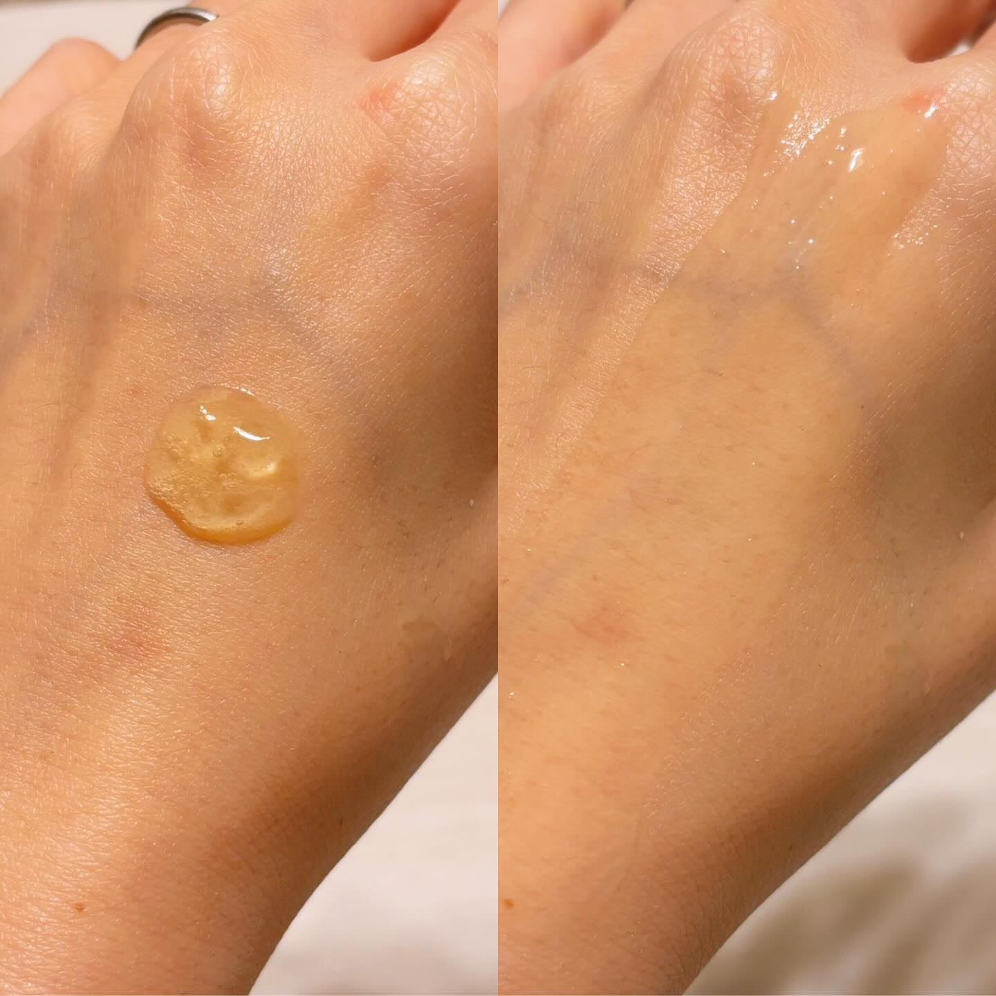 レチノールローション/APLIN/化粧水を使ったクチコミ（2枚目）