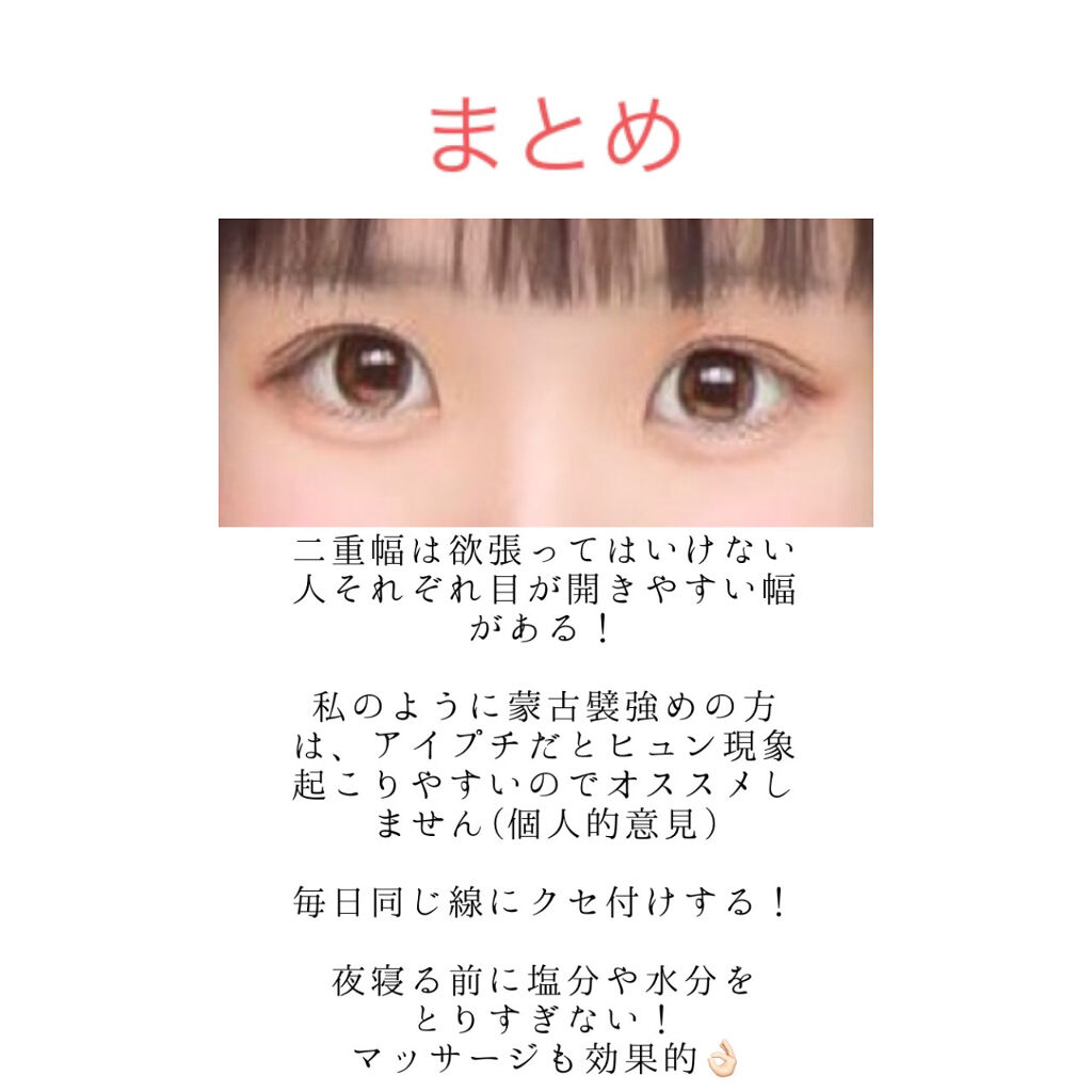 二重になる方法》ナイトアイボーテ｜StreeTrendの使い方や二重