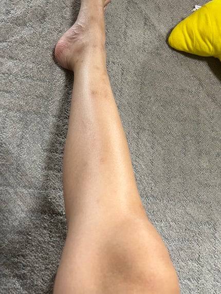 アットノンEX ジェル(医薬品)/アットノン/その他を使ったクチコミ(4枚目)