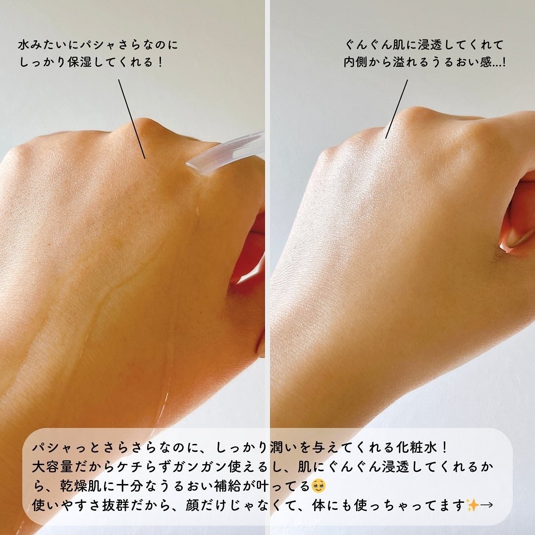 ヘパトリート 薬用保湿化粧水/ゼトックスタイル/化粧水を使ったクチコミ(3枚目)