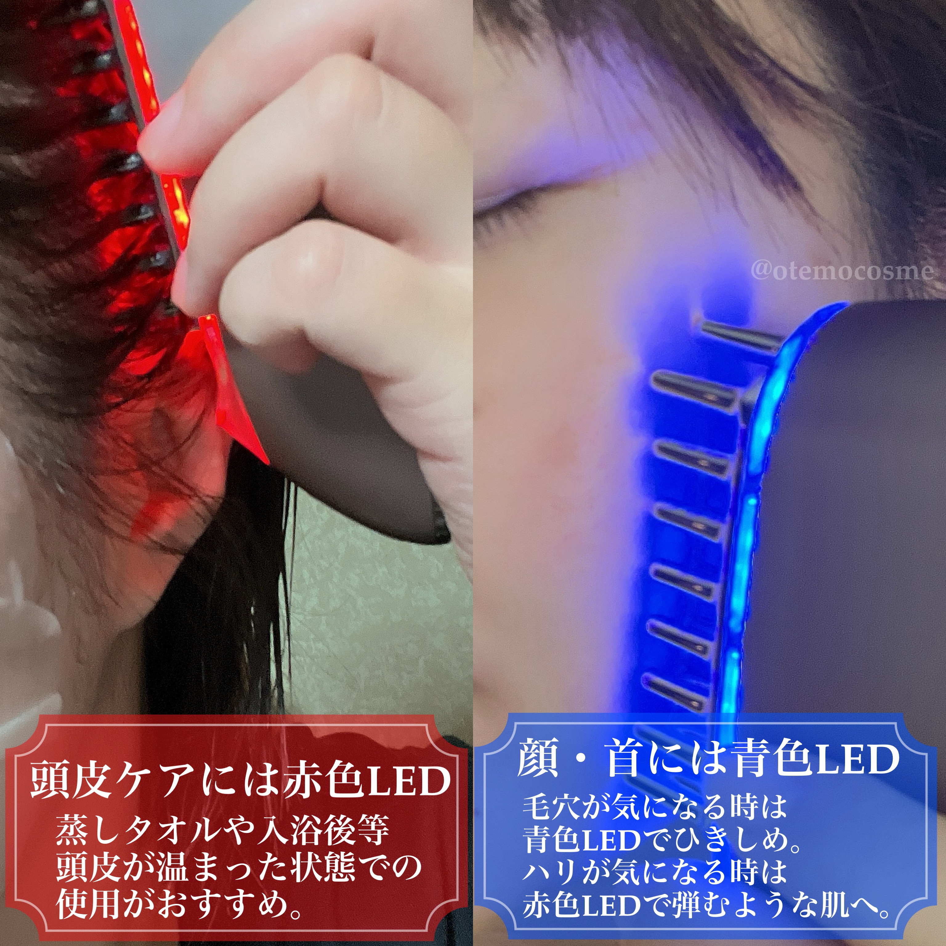 スカルプ電気ブラシ/アンファー(スカルプD)/美顔器・マッサージを使ったクチコミ（2枚目）