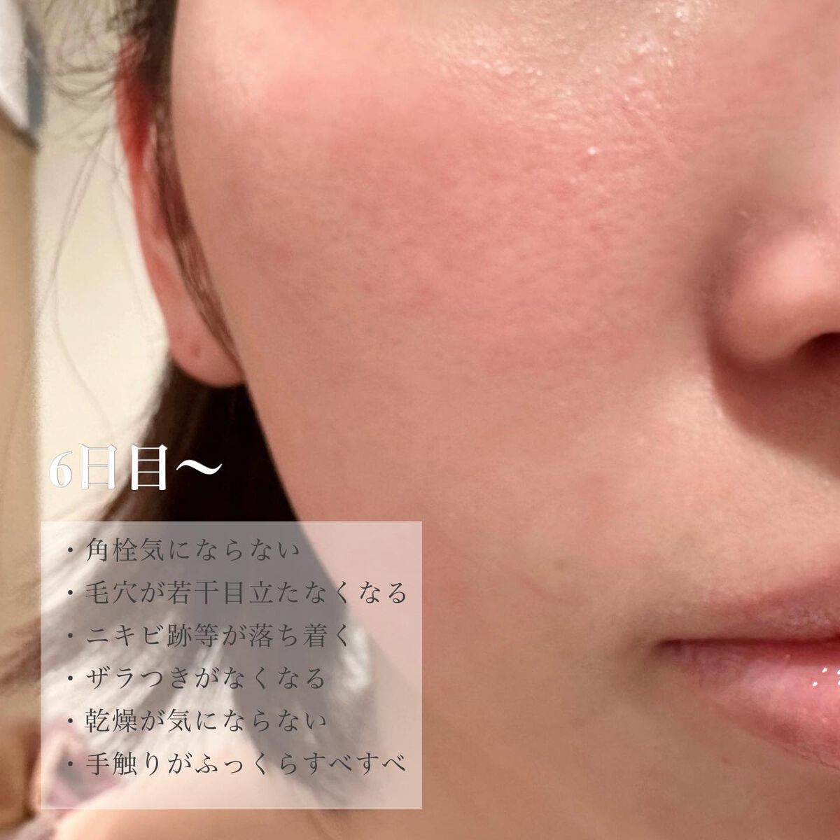 ダーマスキンピーリング/BQCELL/その他キットセットを使ったクチコミ(7枚目)