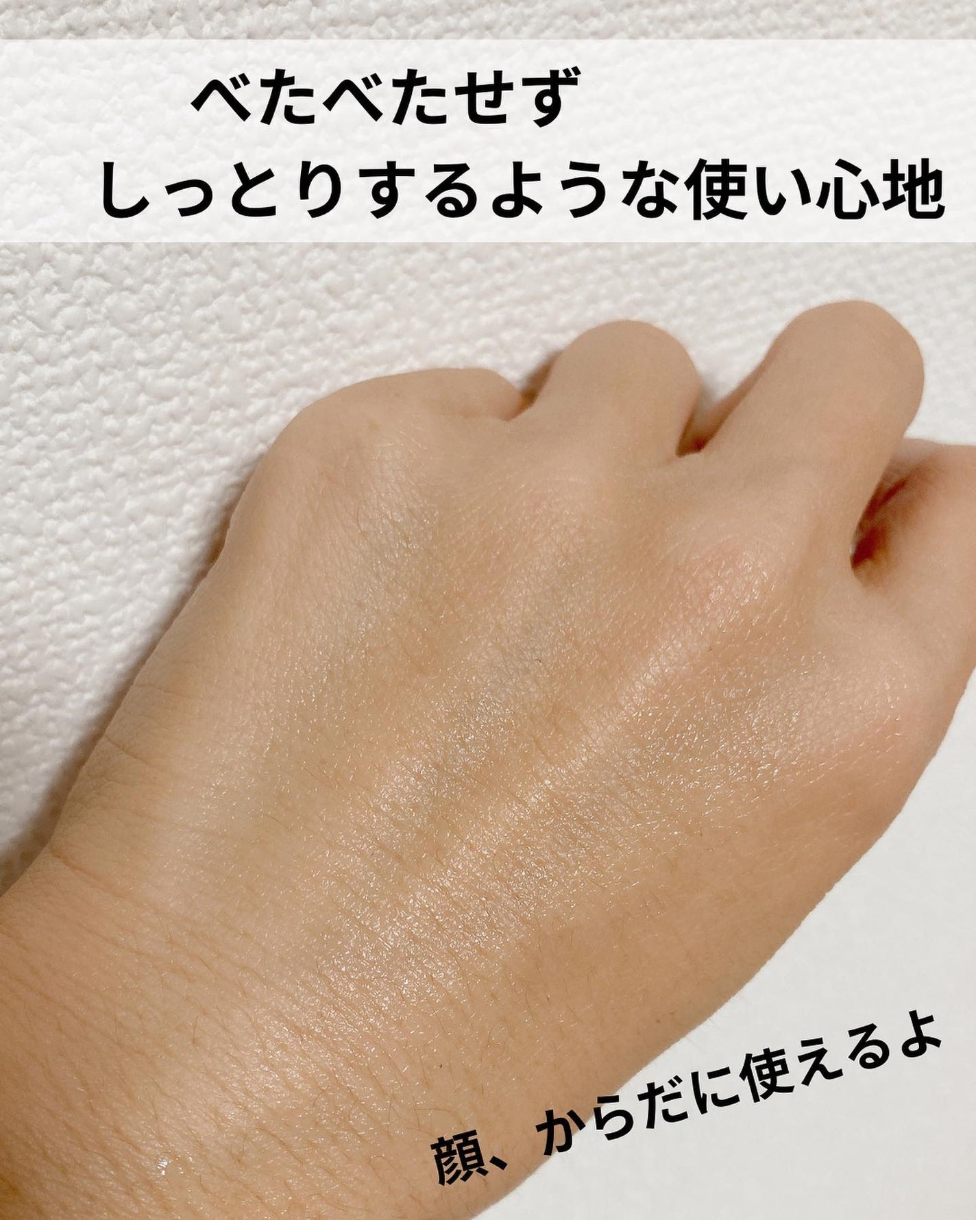 モイスチャーローション/ベビーセバメド/ボディローションを使ったクチコミ(5枚目)