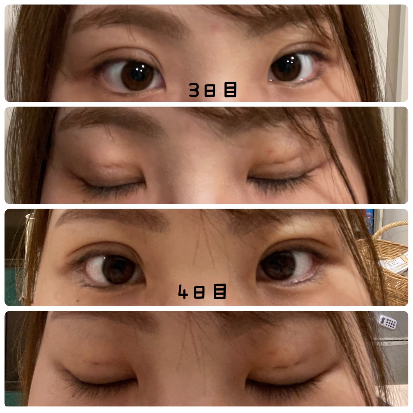 ナイトアイボーテ/StreeTrend/二重まぶた用アイテムを使ったクチコミ(6枚目)