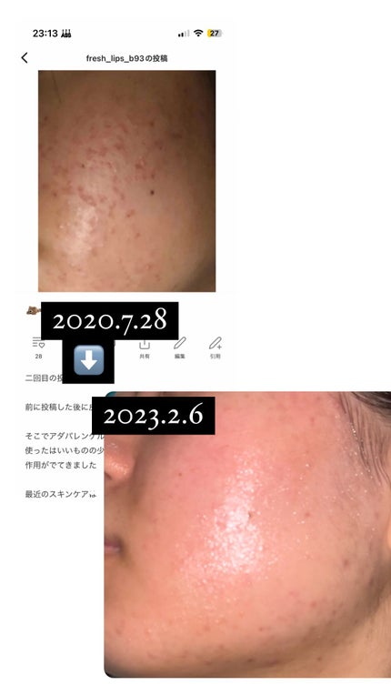 を使ったクチコミ(1枚目)