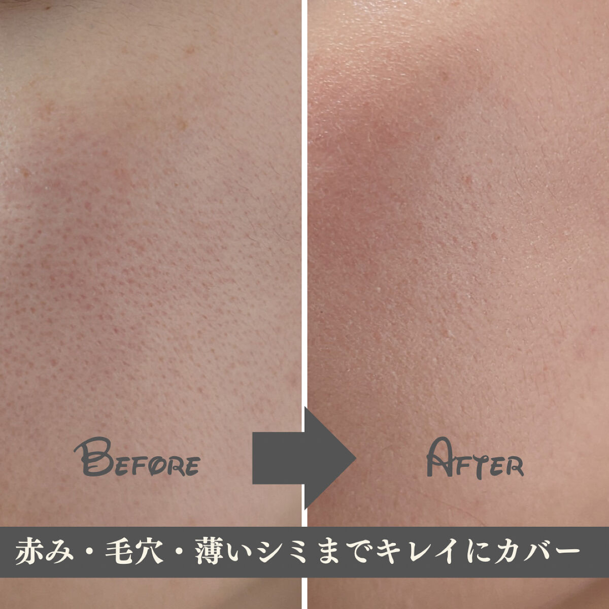 プレミアムニードルファンデーション/ジュエリアプレミアム/クッションファンデーションを使ったクチコミ（3枚目）