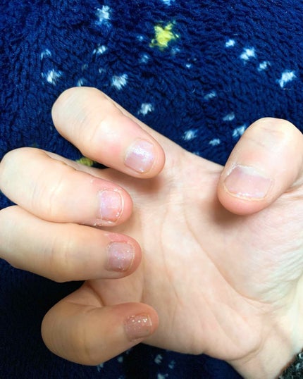 サンリオネイル/DAISO/マニキュアを使ったクチコミ(3枚目)