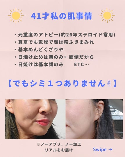 美肌カウンセラー💆肌悩みを解決し見る世界を変える on LIPS 「美肌カウンセラー厳選\シミが敗北するスキンケアを大公開/【シミ..」(3枚目)