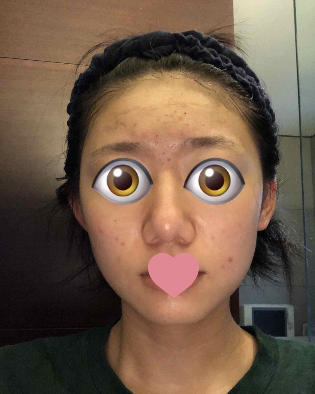 薬用 しみ 集中対策 美容液/メラノCC/美容液を使ったクチコミ(1枚目)