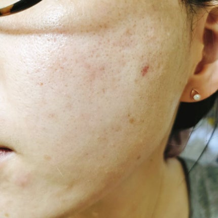 Alpha Arbutin 2% + HA/The Ordinary/フェイスオイルを使ったクチコミ(2枚目)