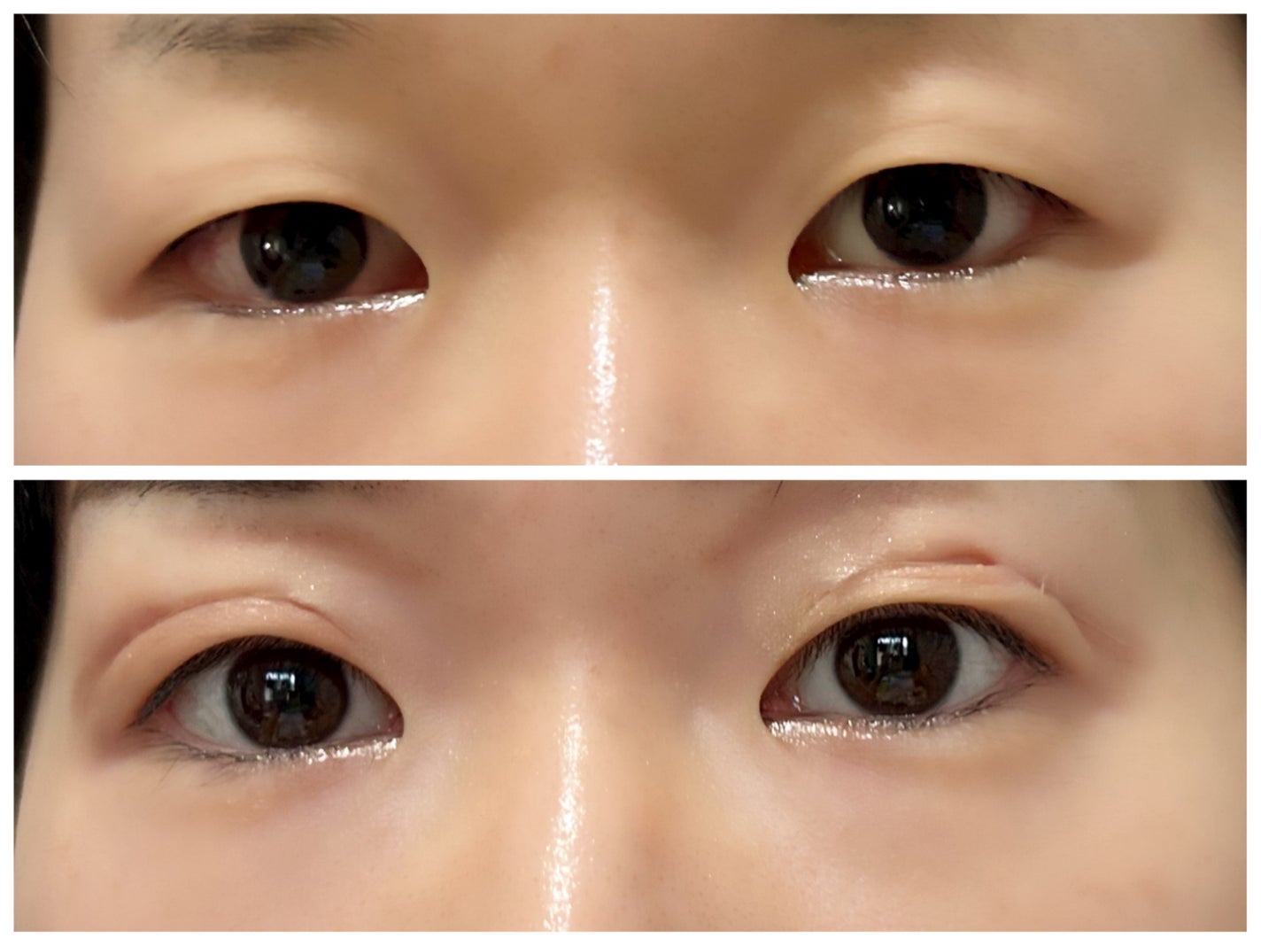 のび〜る アイテープ 両面テープタイプ/DAISO/二重まぶた用アイテムを使ったクチコミ(2枚目)