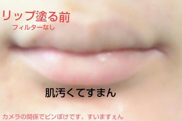 白色ワセリン(医薬品)/健栄製薬/その他を使ったクチコミ（2枚目）