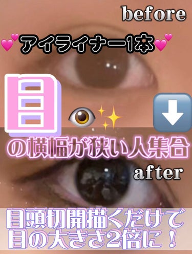 目の横幅狭い人！離れ目で困ってる人集合👀✨

目が2倍大きくなる目頭切開！

分かりやすいように少し濃く描きすぎました💦


皆さん！目頭切開って知ってますか？？？

私の場合ですが、蒙古癖🧏🏻と離れ目