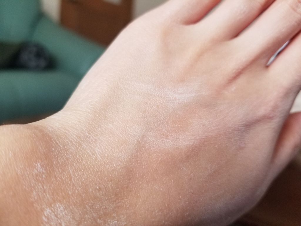 ユースキンA ファミリーメディカルクリーム/ユースキン/ハンドクリームを使ったクチコミ(2枚目)