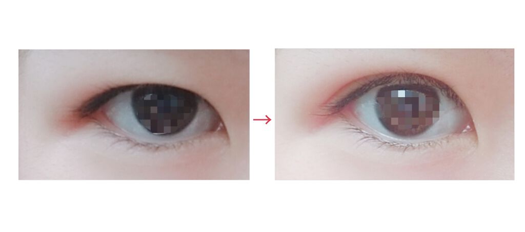 リキッドフィルム/ラクオリ/二重まぶた用アイテムを使ったクチコミ(2枚目)