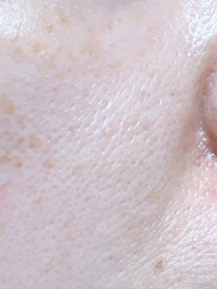 オバジC デイセラムBB/オバジ/BBクリームを使ったクチコミ(8枚目)