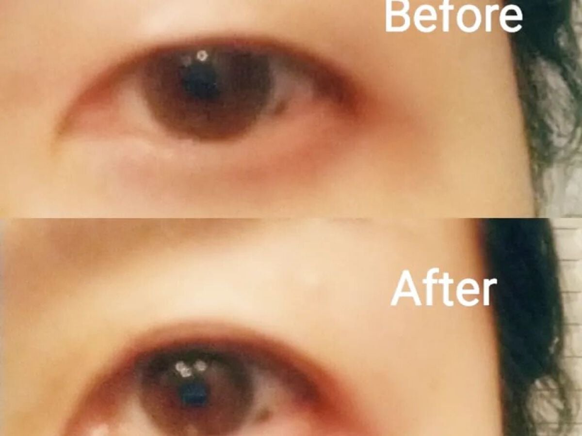 マイクロファイバー /ビー・エヌ/二重まぶた用アイテムを使ったクチコミ(5枚目)