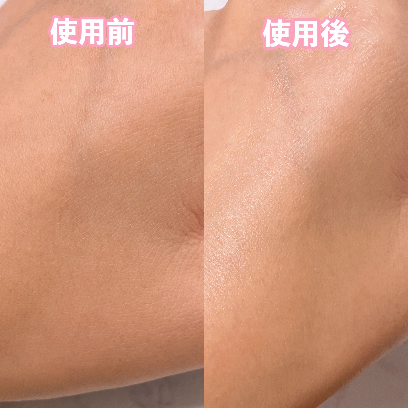 ピンクティーツリートナー/APLIN/化粧水を使ったクチコミ(4枚目)