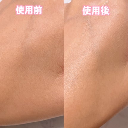 ピンクティーツリートナー/APLIN/化粧水を使ったクチコミ(4枚目)