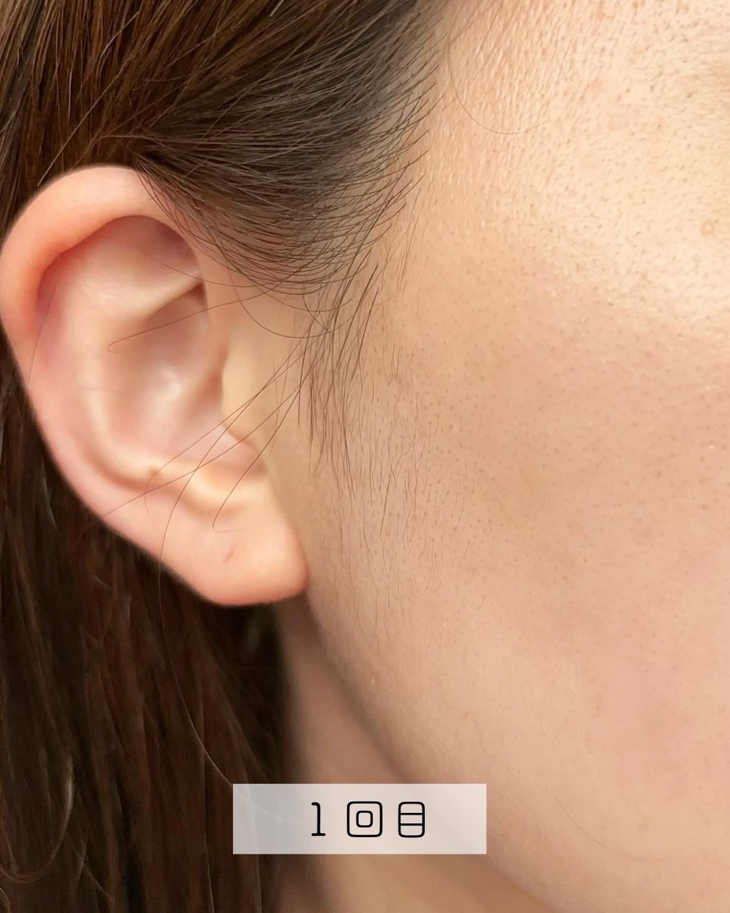 MYTREX MiRAYのクチコミ「⁡
⁡
⁡
⁡
⁡
前回紹介した MYTREX MiRAY ✨
しばらく使ってみたからレポして.....」（2枚目）