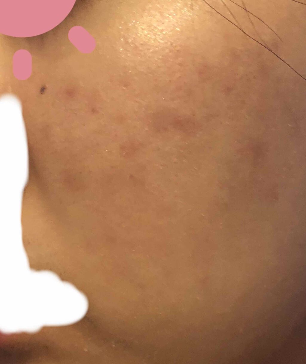 ð£ on LIPS ãããªãè¯ããªããŸããðãã£ãšæ©ãç®èç§ã«è¡ã£ãŠããã°ãããã§ã..ãïŒ3æç®ïŒ