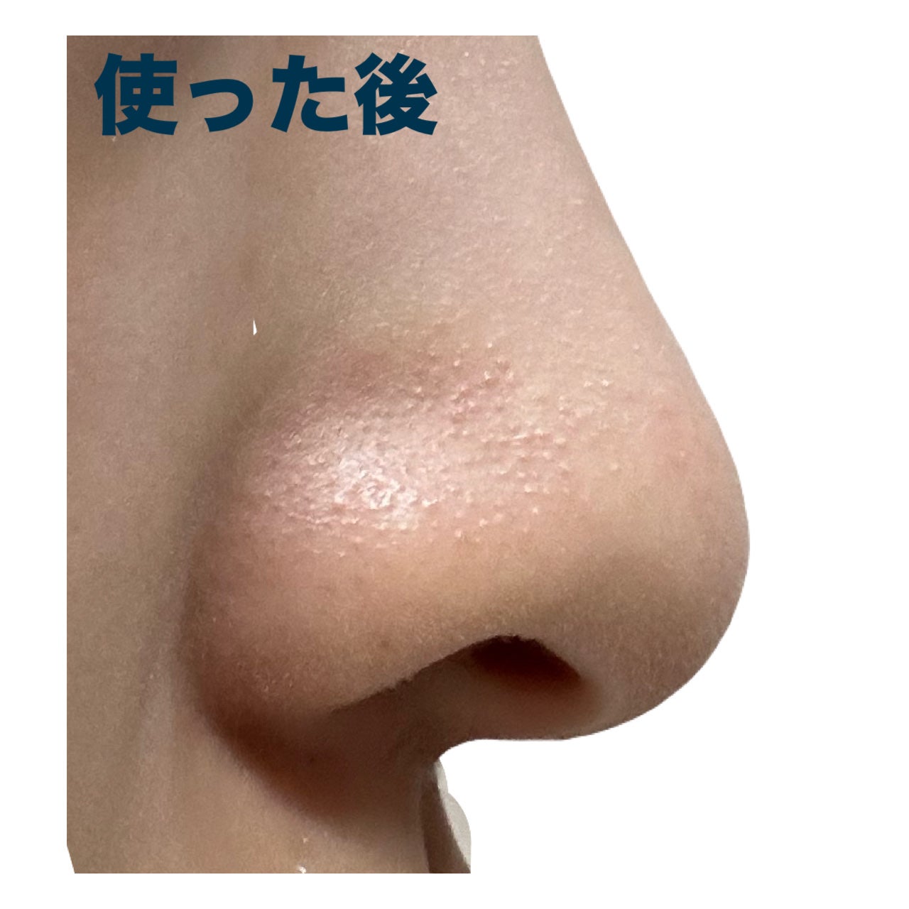 ノーズピーリングパック/One-day's you/シートマスク・パックを使ったクチコミ(7枚目)