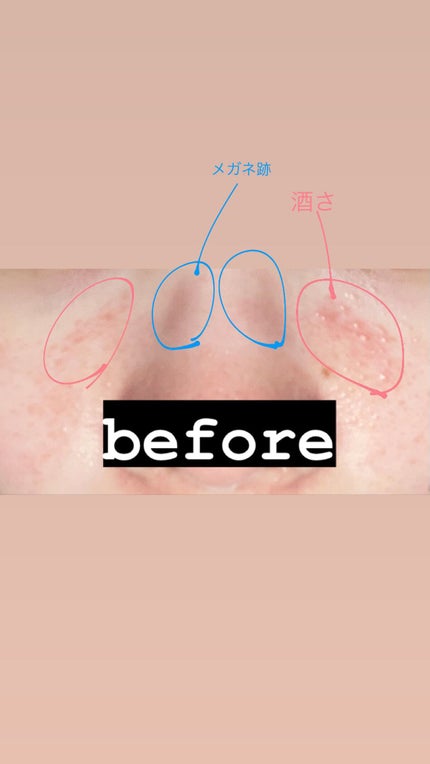 RMK Wトリートメントオイル/RMK/ブースター・導入液を使ったクチコミ(2枚目)