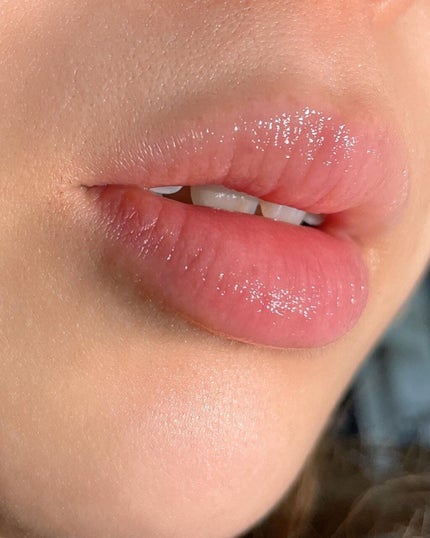 ダーマパワーX リップエッセンス/オバジ/リップ美容液を使ったクチコミ(2枚目)