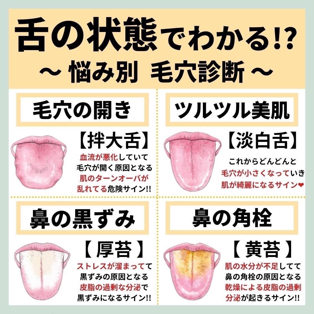 あなたの肌に合ったスキンケア💐コーくん先生 on LIPS 「【9割が知らない】舌がこんな人はめちゃ危険かも🥺...あなたの..」(1枚目)