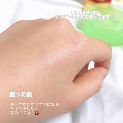 ティーツリーカーミングハイドロジェル/MEDIHEAL/ボディローションを使ったクチコミ(3枚目)