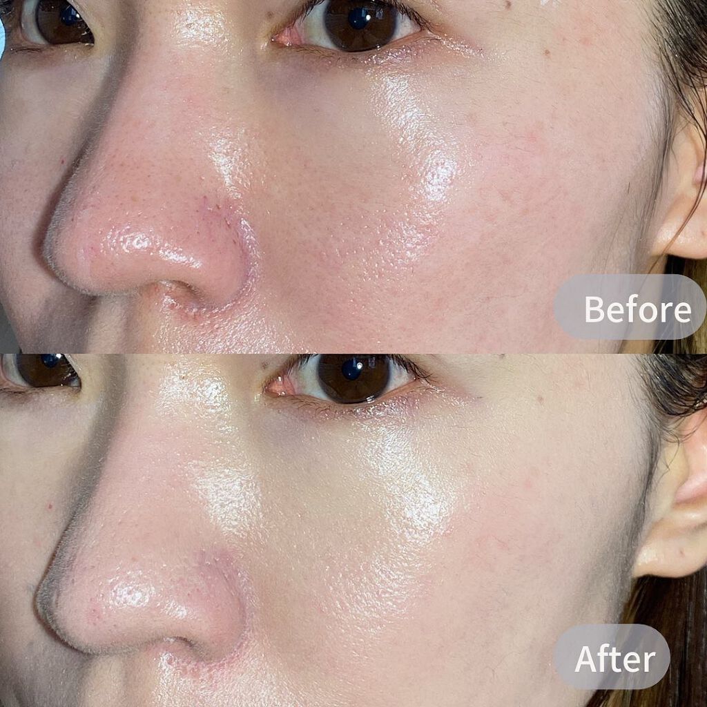 スウィング ミラー クッション/Dr.Althea/クッションファンデーションを使ったクチコミ(6枚目)