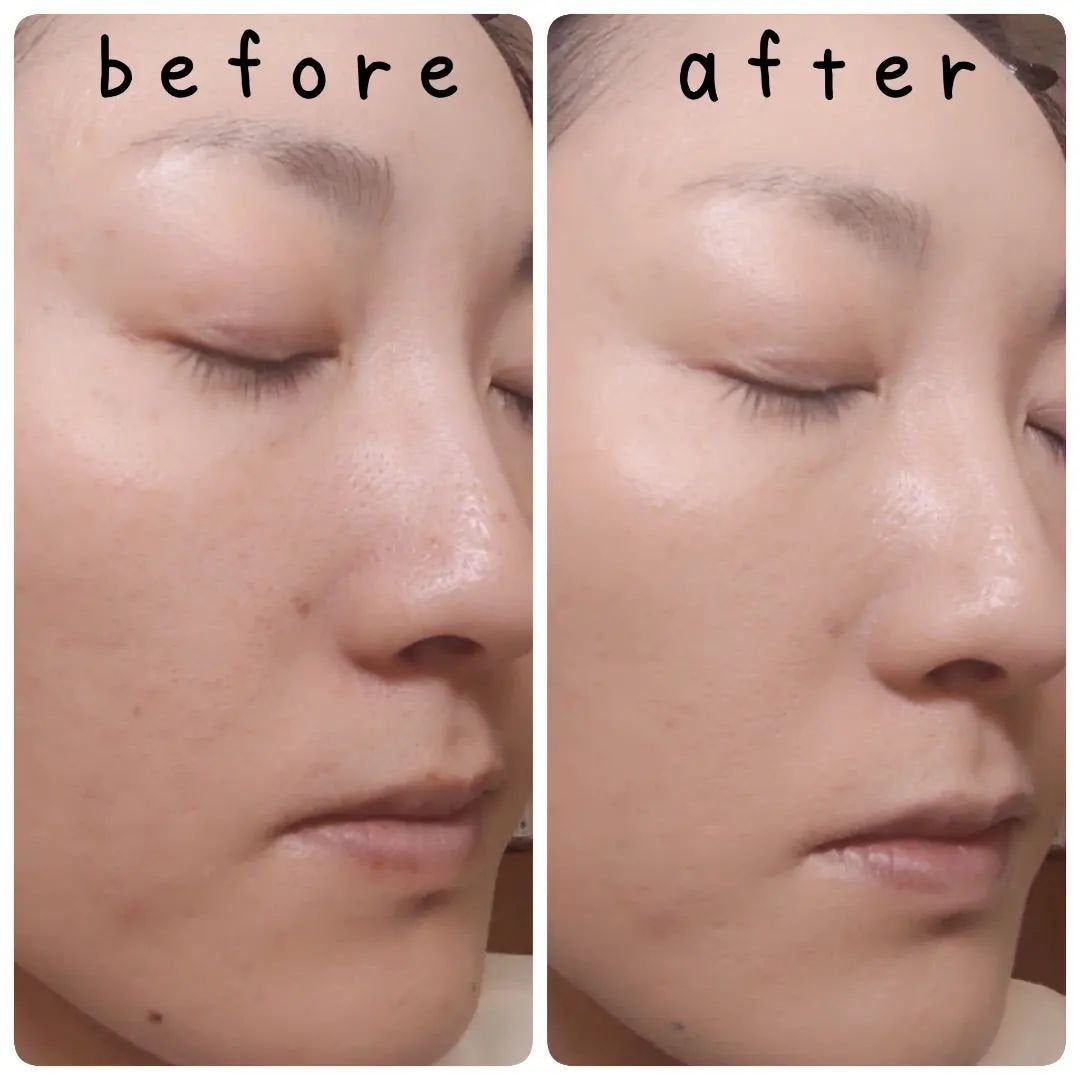 薬用 リンクルホワイトBBクリーム/ONLY MINERALS/BBクリームを使ったクチコミ(2枚目)