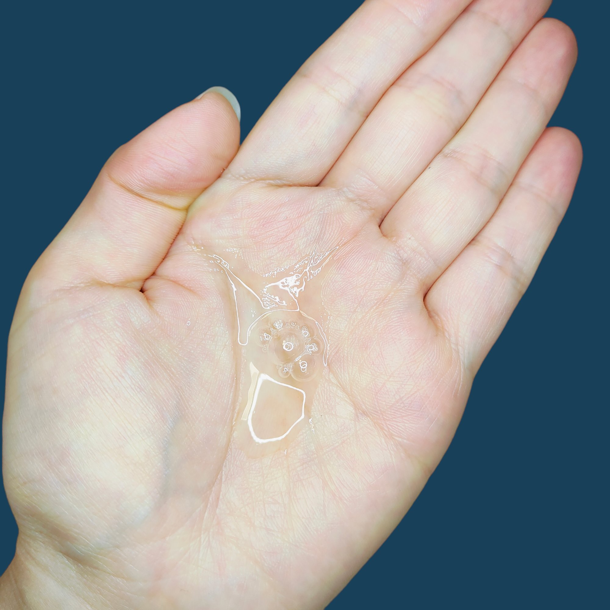 ダーマレーザー ウルセラR/クオリティファースト/美容液を使ったクチコミ（2枚目）