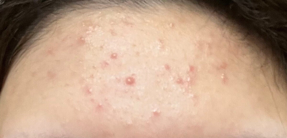 ハトムギ保湿ジェル(ナチュリエ スキンコンディショニングジェル)/ナチュリエ/美容液を使ったクチコミ(1枚目)