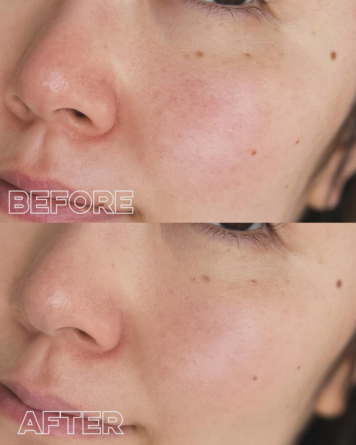 ブラーカバークッション/LUNA/クッションファンデーションを使ったクチコミ(5枚目)