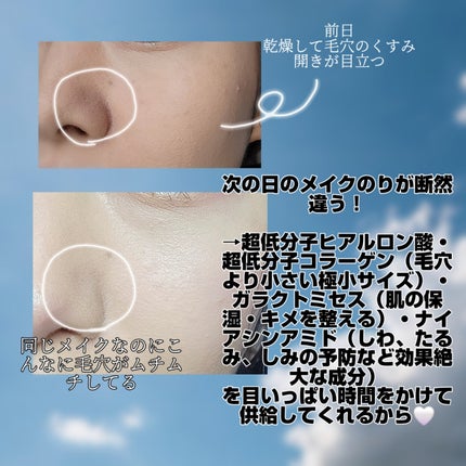 バイオコラーゲンリアルディープマスク/Biodance/シートマスク・パックを使ったクチコミ(5枚目)