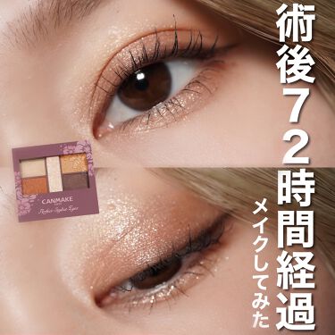 パーフェクトスタイリストアイズ キャンメイクの口コミ まだ腫れてるけど 術後の初メイク アザ By チャンユカ 敏感肌 Lips